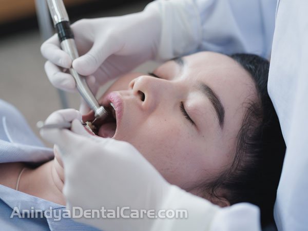 klinik gigi murah di palangkaraya- klinik dokter gigi terbaik di palangkaraya